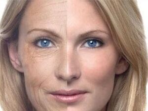 Пигментатсияи пӯст